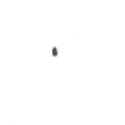 STAR PARTS Star 2C-08-07-0089 Screw Set 1/4-20X3/8 - SKU STA2C-08-07-0089